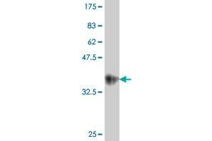 Western Blot detection against Immunogen (35. (Caveolin 3 抗体  (AA 1-83))