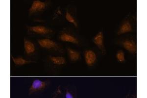 Immunofluorescence analysis of U-2 OS cells using P90RSK Polyclonal Antibody at dilution of 1:100. (RPS6KA3 抗体)
