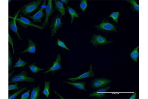 Immunofluorescence of monoclonal antibody to FPR2 on HeLa cell. (FPR2 抗体  (AA 163-205))