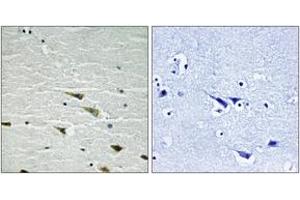 Immunohistochemistry analysis of paraffin-embedded human brain, using Trk A (Phospho-Tyr757) Antibody.
