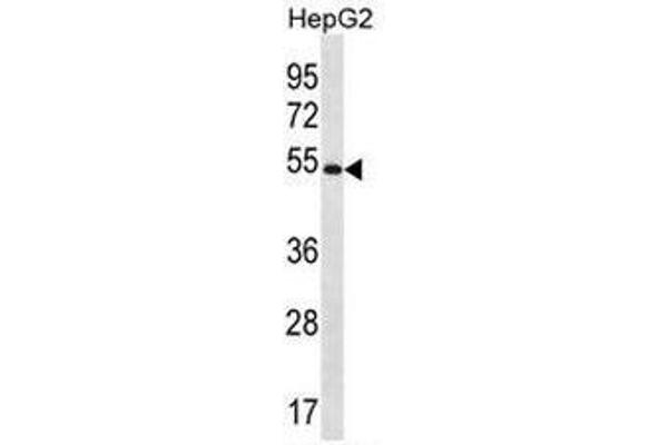 MGAT4C 抗体  (C-Term)