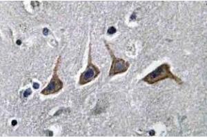 Immunohistochemistry analyzes of SLC22A6 / OAT1 Antibody in paraffin-embedded human brain tissue. (SLC22A6 抗体)