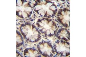 Immunohistochemistry analysis in formalin fixed and paraffin embedded human rectum tissue reacted with AP52511PU-N, which was peroxidase conjugated to the secondary antibody followed by DAB staining. (LNX2 抗体  (C-Term))