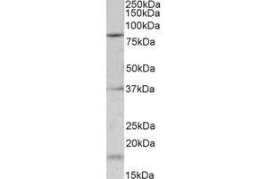 Western Blotting (WB) image for anti-Potassium Voltage-Gated Channel, Shaw-Related Subfamily, Member 3 (KCNC3) (Internal Region) antibody (ABIN2465018) (KCNC3 抗体  (Internal Region))
