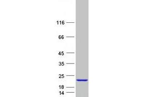 Western Blotting (WB) image for RAB Interacting Factor (RABIF) protein (Myc-DYKDDDDK Tag) (ABIN2730262)