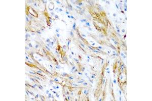 Immunohistochemistry of paraffin-embedded human colon using LMOD1 antibody at dilution of 1:200 (40x lens). (Leiomodin 1 抗体)