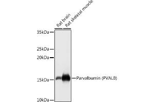 Western blot analysis of extracts of various cell lines, using Parvalbumin (PVALB) antibody (ABIN6128526, ABIN6146506, ABIN6146507 and ABIN6217573) at 1:1000 dilution. (PVALB 抗体  (AA 1-110))