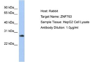 Host: Rabbit Target Name: ZNF763 Sample Type: HepG2 Whole cell lysates Antibody Dilution: 1. (ZNF763 抗体  (C-Term))