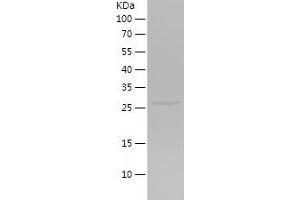 Golgin B1 (GOLGB1) (AA 18-218) protein (His tag)
