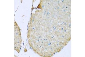 Immunohistochemistry (Paraffin-embedded Sections) (IHC (p)) image for anti-Transmembrane Protein 173 (TMEM173) (AA 170-379) antibody (ABIN1683049)