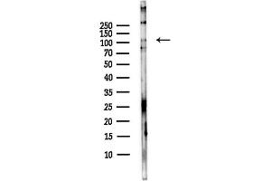 anti-DENN/MADD Domain Containing 1A (DENND1A) antibody