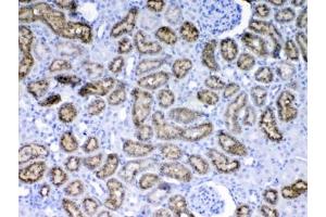 IHC testing of FFPE rat kidney tissue with RBP4 antibody at 1ug/ml. (RBP4 抗体)