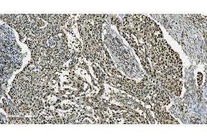 IHC analysis of Transketolase/TKT using anti-Transketolase/TKT antibody (ABIN7598958).