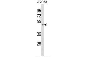 BFAR Antibody (N-term) western blot analysis in A2058 cell line lysates (35µg/lane). (BFAR 抗体  (N-Term))