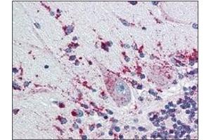 Immunohistochemistry (IHC) image for anti-Cathepsin D (CTSD) (AA 21-412) antibody (ABIN317502) (Cathepsin D 抗体  (AA 21-412))