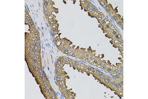 Immunohistochemistry of paraffin-embedded human prostate using SUMO3 antibody (ABIN5971585) (40x lens). (SUMO3 抗体)