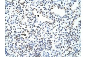 POGZ antibody was used for immunohistochemistry at a concentration of 4-8 ug/ml to stain Alveolar cells (arrows) in Human Lung. (POGZ 抗体  (N-Term))