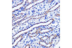Immunohistochemistry of paraffin-embedded mouse kidney using PHLPP1 Rabbit pAb (ABIN6128434, ABIN6145573, ABIN6145574 and ABIN6225035) at dilution of 1:100 (40x lens). (PHLPP1 抗体  (AA 1508-1717))