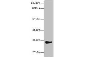 Western blot All lanes: MRPL22 antibody at 12 μg/mL + SH-SY5Y whole cell lysate Secondary Goat polyclonal to rabbit IgG at 1/10000 dilution Predicted band size: 24, 14, 15 kDa Observed band size: 24 kDa (MRPL22 抗体  (AA 41-206))