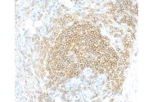 Immunohistochemistry (IHC) image for anti-CD19 Molecule (CD19) (AA 19-287) antibody (ABIN7455123) (Recombinant CD19 抗体  (AA 19-287))