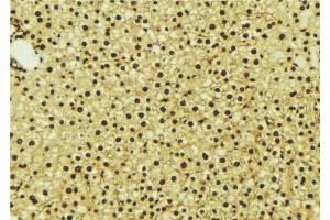 ABIN6276988 at 1/100 staining Mouse liver tissue by IHC-P. (NR1I3 抗体  (Internal Region))
