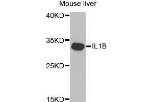 Western Blotting (WB) image for anti-Interleukin 1, beta (IL1B) (AA 1-269) antibody (ABIN3021462) (IL-1 beta 抗体  (AA 1-269))