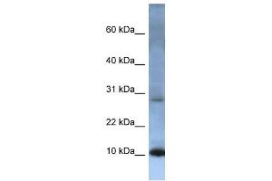 ATP5G2 antibody used at 1 ug/ml to detect target protein.