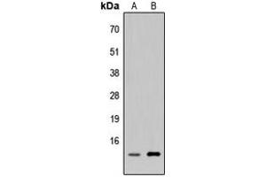 Western blot analysis of p311 expression in HEK293T (A), H9C2 (B) whole cell lysates. (NREP 抗体  (Center))