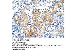 Human kidney (SOX15 抗体  (Middle Region))