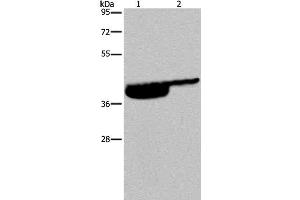Western Blot analysis of Human bladder and bladder transitional cell carcinoma tissue using P2RX3 Polyclonal Antibody at dilution of 1:250 (P2RX3 抗体)