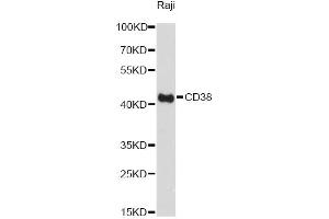 Western blot analysis of extracts of Raji cells, using CD38 Antibody. (CD38 抗体)