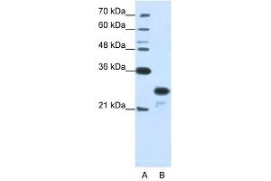 ANP32A antibody used at 1. (PHAP1 抗体)