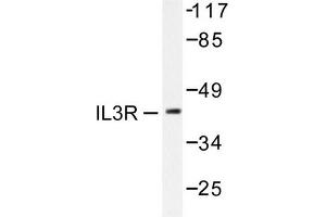 Image no. 2 for anti-Interleukin 3 Receptor, alpha (IL3RA) antibody (ABIN265478) (IL3RA 抗体)