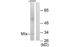 Western blot analysis of extracts from LOVO cells, using Mlx antibody. (MLX 抗体  (Internal Region))