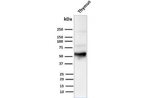 Western Blot Analysis of human Thymus tissue lysate using Cytokeratin 10 Mouse Monoclonal Antibody (LH2). (Keratin 10 抗体)