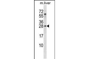Western blot analysis in mouse liver tissue lysates (35ug/lane). (RAB5B 抗体  (AA 85-112))