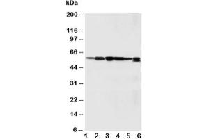Western blot testing of SSH3BP1 antibody and Lane 1:  rat liver;  2: rat brain;  3: MM231;  4: HeLa;  5: SMMC-7721;  6: Jurkat cell lysate (ABI1 抗体  (C-Term))