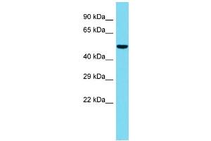 Host: Rabbit  Target Name: Gpatc2  Sample Tissue: Rat Spleen lysates  Antibody Dilution: 1. (GPATCH2 抗体  (C-Term))