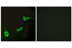 Immunofluorescence analysis of LOVO cells, using ADRA1B antibody. (ADRA1B 抗体  (C-Term))