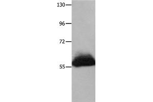 Western Blotting (WB) image for anti-Heparanase (HPSE) antibody (ABIN2428228) (HPSE 抗体)