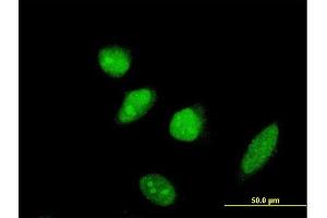 Immunofluorescence of monoclonal antibody to SCML2 on HeLa cell. (SCML2 抗体  (AA 251-350))