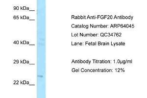 Western Blotting (WB) image for anti-Fibroblast Growth Factor 20 (FGF20) (C-Term) antibody (ABIN2789708) (FGF20 抗体  (C-Term))