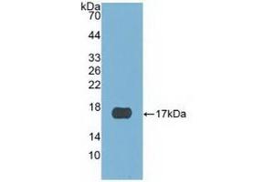 Detection of Recombinant CST6, Human using Polyclonal Antibody to Cystatin 6 (CST6) (CST6 抗体  (AA 29-149))