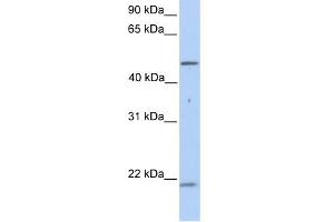 WB Suggested Anti-KRT10 Antibody Titration:  0. (Keratin 10 抗体  (N-Term))