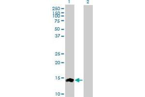 Western Blot analysis of CCL24 expression in transfected 293T cell line by CCL24 MaxPab polyclonal antibody. (CCL24 抗体  (AA 1-119))