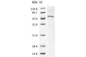 (Tris-Glycine gel) Discontinuous SDS-PAGE (reduced) with 5 % enrichment gel and 15 % separation gel.