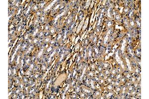 ABIN7095283 and ABIN7099340 at 1/100 staining mouse kidney tissue by IHC-P. (IFT74 抗体)