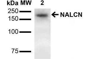 Western Blot analysis of Rat Brain showing detection of ~200 kDa NALCN protein using Mouse Anti-NALCN Monoclonal Antibody, Clone S187-7 . (NALCN 抗体  (AA 1659-1738) (PerCP))