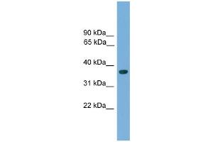 WB Suggested Anti-Hoxa1 Antibody Titration:  0. (HOXA1 抗体  (C-Term))