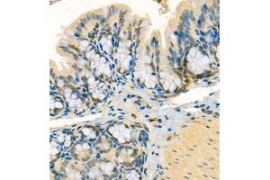 Immunohistochemistry (Paraffin-embedded Sections) (IHC (p)) image for anti-Prothymosin, alpha (PTMA) antibody (ABIN7075306)